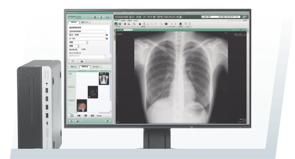 胸部レントゲンにもAIシステム導入